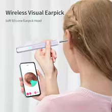 Wireless Smart Visual Ear Cleaner